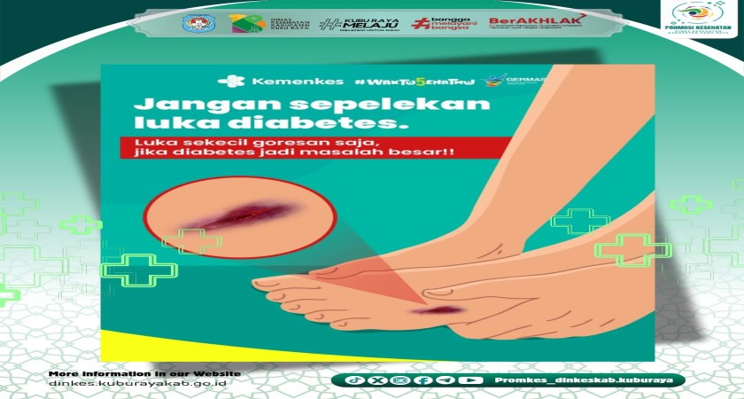 Jangan Sepelekan Luka Diabetes