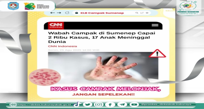 Waspada Kenaikan Kasus Campak (2/9)