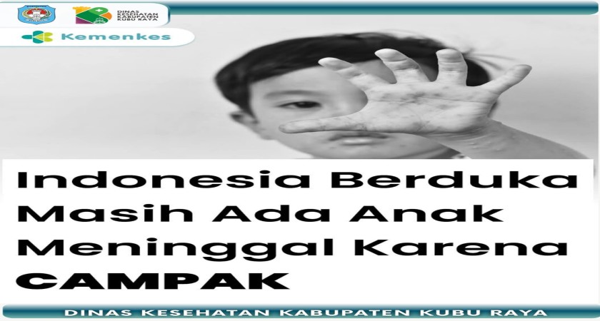 Campak Kembali Merenggut Nyawa Anak Anak Indonesia